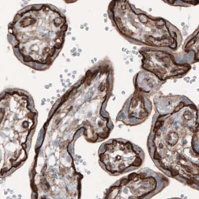 Immunohistochemistry-Paraffin: beta-Catenin Antibody (CL3691) [NBP2-61629]