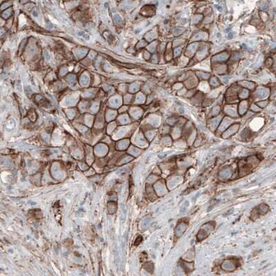 Immunohistochemistry-Paraffin: beta-Catenin Antibody (CL3691) [NBP2-61629]