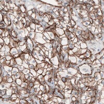 Immunohistochemistry-Paraffin: beta-Catenin Antibody (CL3691) [NBP2-61629]