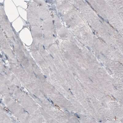 Immunohistochemistry-Paraffin: beta-Catenin Antibody (CL3691) [NBP2-61629]