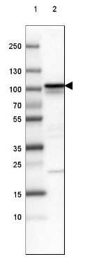 Western Blot: beta-Catenin Antibody (CL3691) [NBP2-61629]