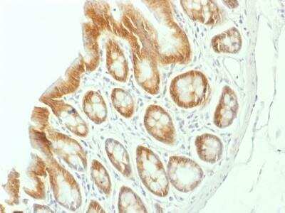 Immunohistochemistry-Paraffin: beta-Catenin Antibody (CTNNB1/1507) - Azide and BSA Free [NBP2-54542]