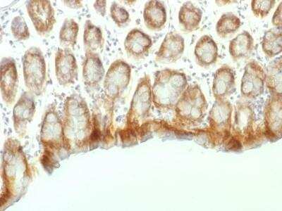Immunohistochemistry-Paraffin: beta-Catenin Antibody (CTNNB1/1507) - Azide and BSA Free [NBP2-54542]