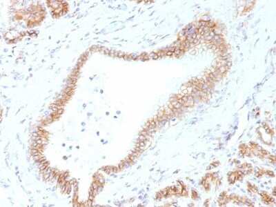 Immunohistochemistry-Paraffin: beta-Catenin Antibody (CTNNB1/1507) [NBP2-53361]