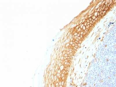 Immunohistochemistry-Paraffin: beta-Catenin Antibody (CTNNB1/1507) [NBP2-53361]