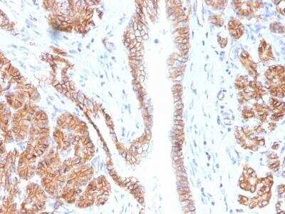 Immunohistochemistry-Paraffin: beta-Catenin Antibody (CTNNB1/1508) - Azide and BSA Free [NBP2-54541]