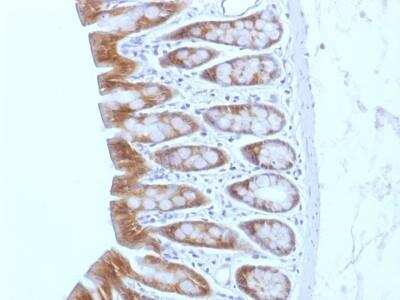 Immunohistochemistry-Paraffin: beta-Catenin Antibody (CTNNB1/1508) - Azide and BSA Free [NBP2-54541]