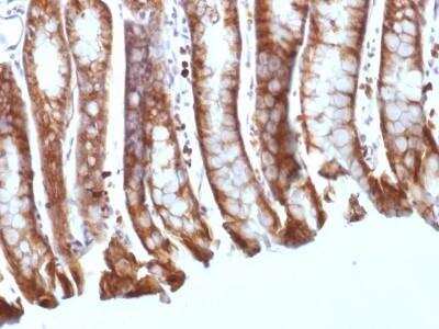 Immunohistochemistry-Paraffin: beta-Catenin Antibody (CTNNB1/1508) - Azide and BSA Free [NBP2-54541]