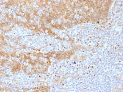 Immunohistochemistry-Paraffin: beta-Catenin Antibody (CTNNB1/1508) [NBP2-53365]