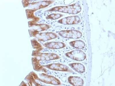 Immunohistochemistry-Paraffin: beta-Catenin Antibody (CTNNB1/1508) [NBP2-53365]