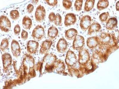 Immunohistochemistry-Paraffin: beta-Catenin Antibody (CTNNB1/1509) - Azide and BSA Free [NBP2-54540]
