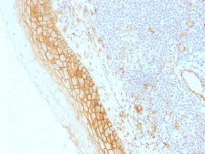 Immunohistochemistry-Paraffin: beta-Catenin Antibody (CTNNB1/1509) [NBP2-53366]