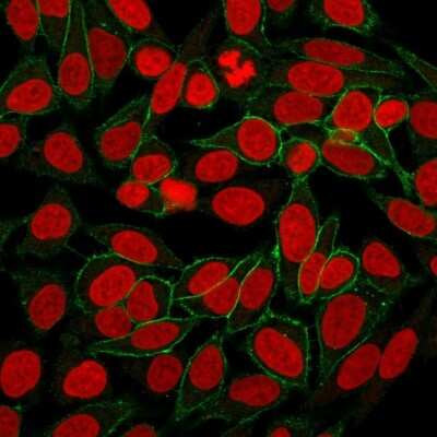 Immunocytochemistry/ Immunofluorescence: beta-Catenin Antibody (CTNNB1/2030R) [NBP2-79753]