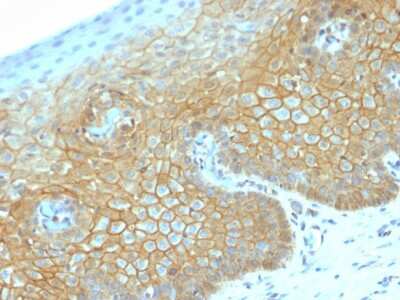 Immunohistochemistry-Paraffin: beta-Catenin Antibody (CTNNB1/2030R) [NBP2-79753]