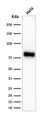 Western Blot: beta-Catenin Antibody (CTNNB1/2030R) [NBP2-79753]