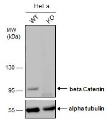 Western Blot: beta-Catenin Antibody (GT2169) [NBP3-13530]