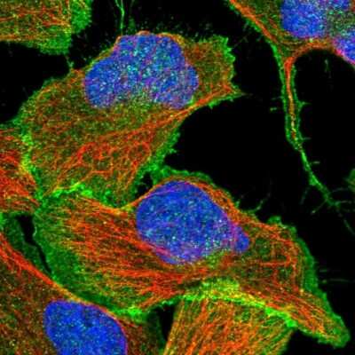 Immunocytochemistry/ Immunofluorescence: beta-Catenin Antibody [NBP1-89989]