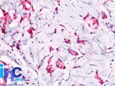 Immunohistochemistry-Paraffin: beta-Catenin Antibody [NBP2-29476]