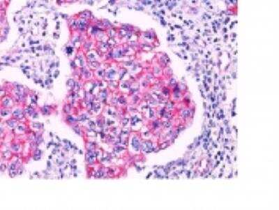 Immunohistochemistry-Paraffin: beta-Catenin Antibody [NBP2-29476]