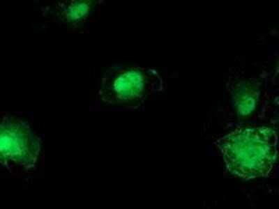 Immunocytochemistry/ Immunofluorescence: beta-Catenin Antibody (OTI12H7) - Azide and BSA Free [NBP2-70509]