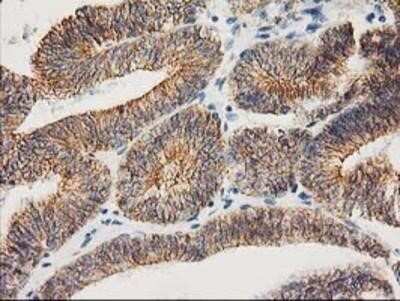 Immunohistochemistry: beta-Catenin Antibody (OTI12H7) - Azide and BSA Free [NBP2-70509]