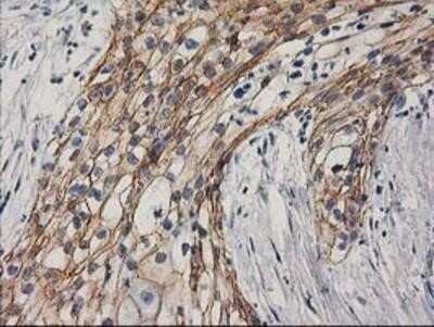 Immunohistochemistry: beta-Catenin Antibody (OTI12H7) - Azide and BSA Free [NBP2-70509]