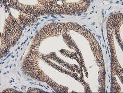 Immunohistochemistry: beta-Catenin Antibody (OTI12H7) - Azide and BSA Free [NBP2-70509]