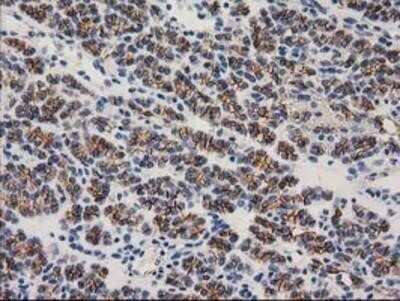 Immunohistochemistry: beta-Catenin Antibody (OTI12H7) - Azide and BSA Free [NBP2-70509]