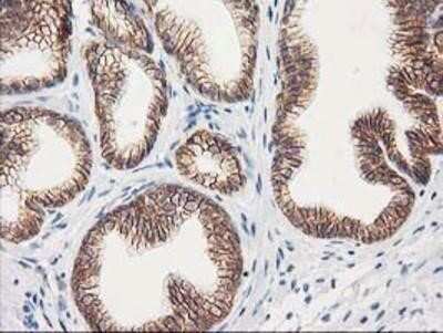 Immunohistochemistry: beta-Catenin Antibody (OTI12H7) - Azide and BSA Free [NBP2-70509]