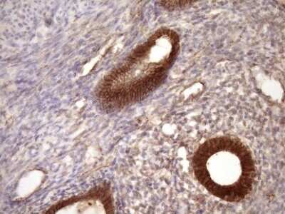 Immunohistochemistry: beta-Catenin Antibody (OTI2F10) - Azide and BSA Free [NBP2-70511]