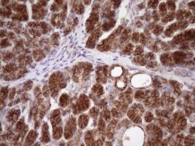 Immunohistochemistry: beta-Catenin Antibody (OTI2F10) - Azide and BSA Free [NBP2-70511]