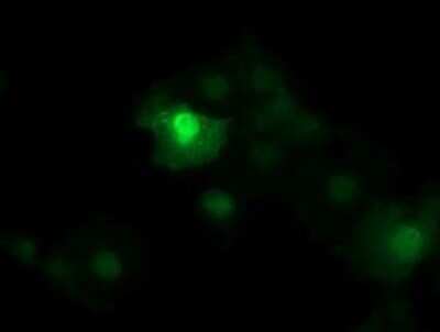 Immunocytochemistry/ Immunofluorescence: beta-Catenin Antibody (OTI9C1) - Azide and BSA Free [NBP2-70508]