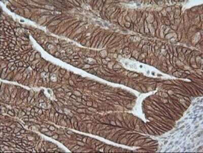 Immunohistochemistry: beta-Catenin Antibody (OTI9C1) - Azide and BSA Free [NBP2-70508]