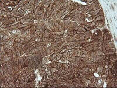 Immunohistochemistry: beta-Catenin Antibody (OTI9C1) - Azide and BSA Free [NBP2-70508]