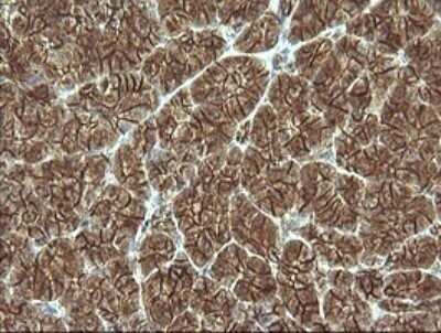 Immunohistochemistry: beta-Catenin Antibody (OTI9C1) - Azide and BSA Free [NBP2-70508]