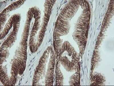 Immunohistochemistry: beta-Catenin Antibody (OTI9C1) - Azide and BSA Free [NBP2-70508]