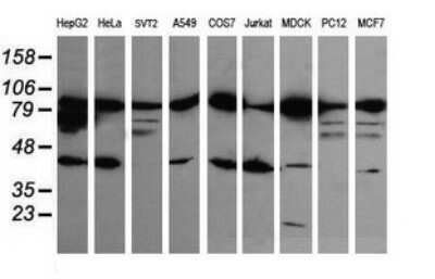 Western Blot: beta-Catenin Antibody (OTI9C1)Azide and BSA Free [NBP2-70508]