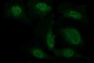 Immunofluorescence: beta-Catenin Antibody (OTI9C1) [NBP2-46400]