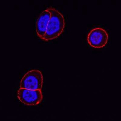 Immunocytochemistry: beta-Catenin Antibody (SA30-04) [NBP2-67307]