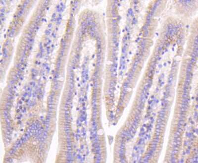 Immunohistochemistry-Paraffin: beta-Catenin Antibody (SA30-04) [NBP2-67307]