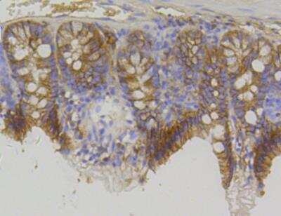 Immunohistochemistry-Paraffin: beta-Catenin Antibody (SA30-04) [NBP2-67307]