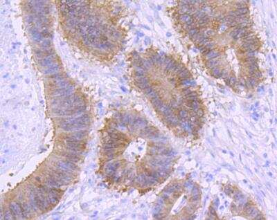 Immunohistochemistry-Paraffin: beta-Catenin Antibody (SA30-04) [NBP2-67307]
