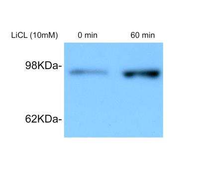 Western Blot: beta-Catenin Antibody [NBP1-32239]