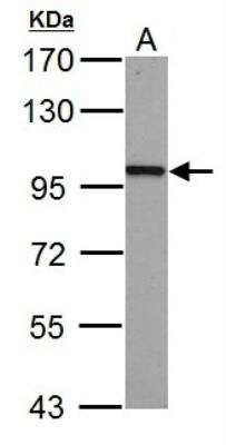 Western Blot: beta-Catenin Antibody [NBP1-32239]