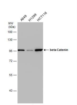 Western Blot: beta-Catenin Antibody [NBP1-32239]