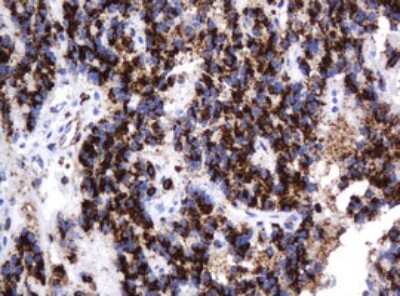 Immunohistochemistry: beta-Galactosidase-1/GLB1 Antibody (OTI1C9) [NBP2-45731]