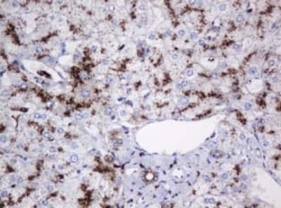 Immunohistochemistry: beta-Galactosidase-1/GLB1 Antibody (OTI1C9) [NBP2-45731]