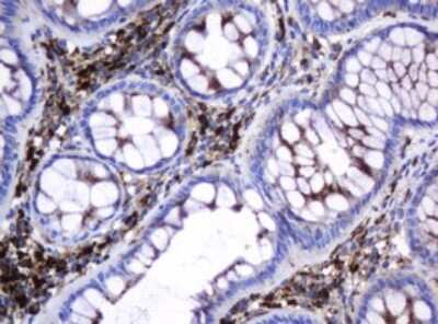 Immunohistochemistry: beta-Galactosidase-1/GLB1 Antibody (OTI1C9) [NBP2-45731]