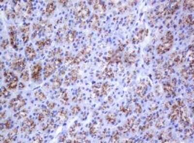 Immunohistochemistry: beta-Galactosidase-1/GLB1 Antibody (OTI1C9) [NBP2-45731]