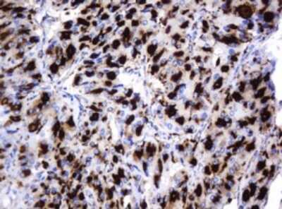 Immunohistochemistry: beta-Galactosidase-1/GLB1 Antibody (OTI1C9) [NBP2-45731]